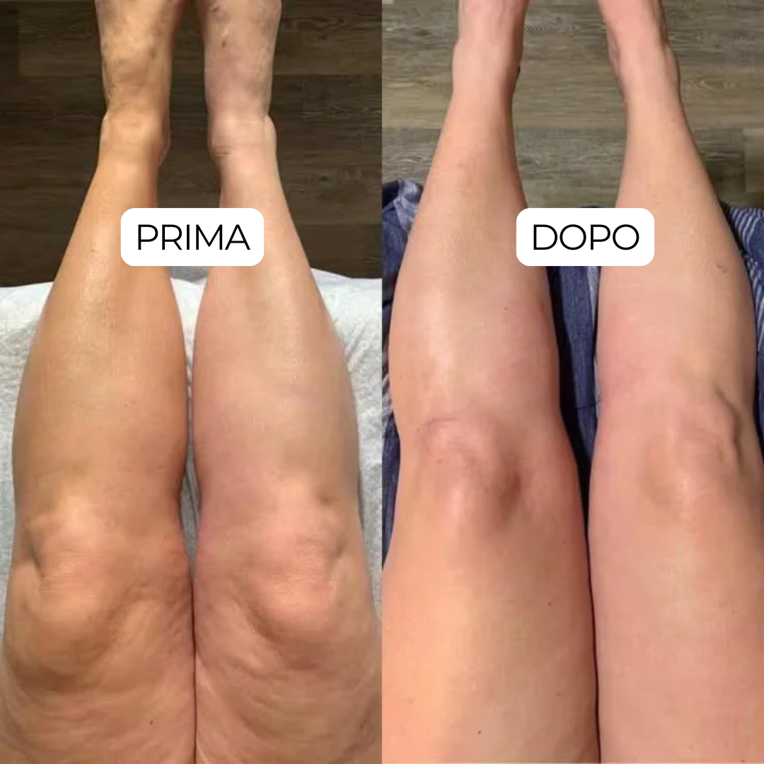 GOCCE di BENESSERE per il DRENAGGIO LINFATICO