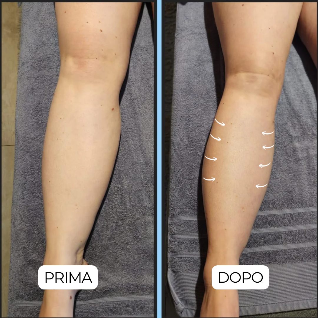 GOCCE di BENESSERE per il DRENAGGIO LINFATICO