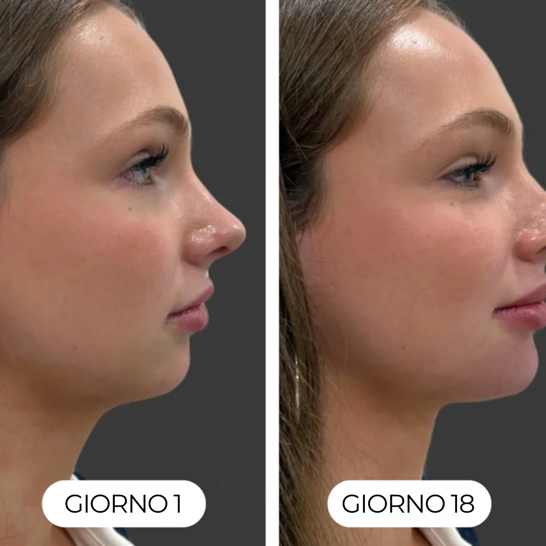 GOCCE di BENESSERE per il DRENAGGIO LINFATICO